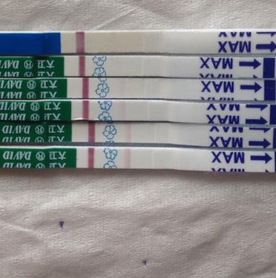 哪个是比较好的试管婴儿方案？常用的排卵方案是什么？