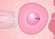 三代试管婴儿进周后的流程和费用解读！2026总花费多少钱？