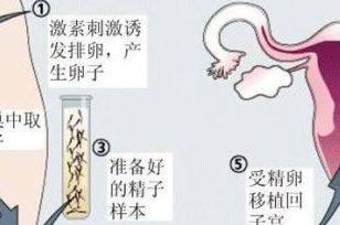 试管宝宝，后，吃牛蛙要当心，饮食禁忌早知道