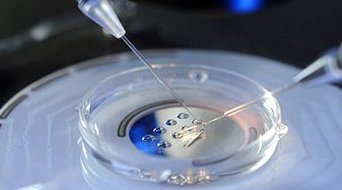 试管婴儿费用价格有差异，内附各国试管费用对比