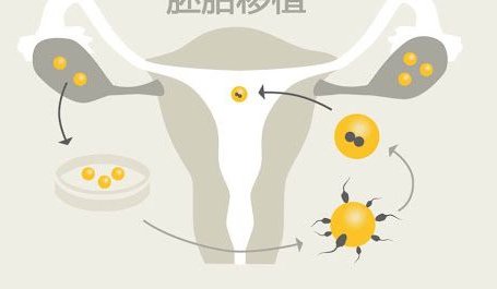 青岛私立机构三代试管婴儿医院收费普遍贵吗？